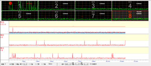 超聲波A掃描 超聲波A掃描